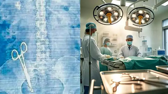 गर्भवती महिलाको पेटबाट निकालियो कैँची, १७ वर्ष अघिको घटनासँग थियो साइनो
